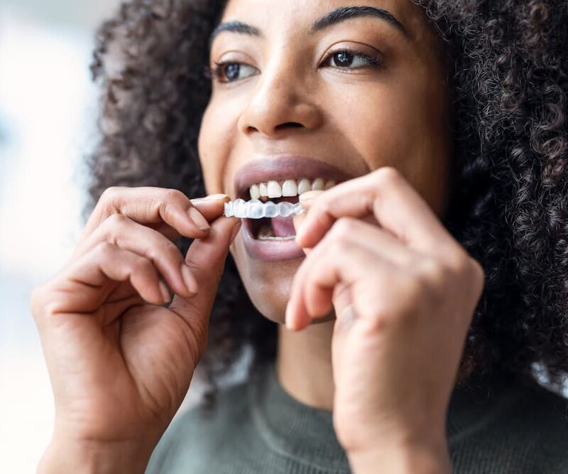 Invisalign Pebble Beach Dental